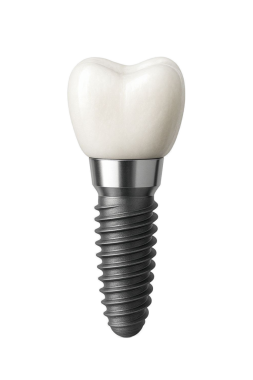 Diş implantları beyaza izole edildi, takma dişler