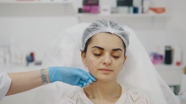 美容整形の準備をしている患者のクローズアップ 美容師は ボツリヌス毒素の導入前に補正点を置き 顔をマークします 高品質4Kビデオ — ストック動画