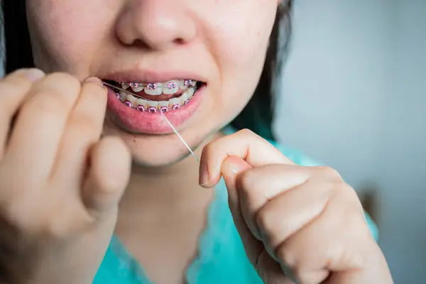 Young Girl with Braces Doing Oral Hygiene Routine by Using Dental Floss to Clean Her Teeth in the Bathroom. High quality photo