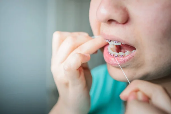 Close up of young woman with braces using dental floss to clean her teeth in the bathroom. Oral Hygiene routine. High quality photo
