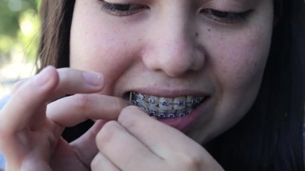 Nahaufnahme Einer Jungen Frau Mit Zahnspange Die Gummibänder Auf Ihre — Stockvideo
