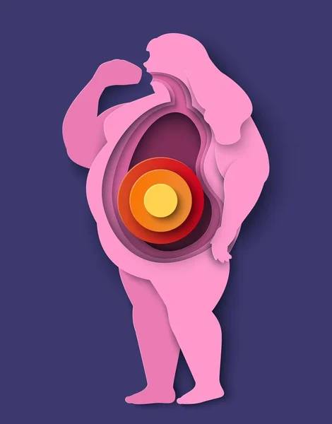 Ilustrace Ikon Tlustých Lidí Vektorová Žena Nadváhou Žaludečními Potížemi Užívá — Stockový vektor