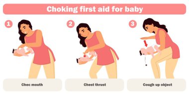 Choking first aid for baby infographic for mother education vector illustration. Heimlich maneuver rescue technique with correct subsequence for unblock infant kid breathing clipart