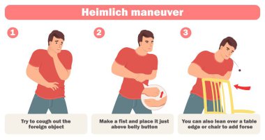 Heimlich, vektör illüstrasyonunu boğarak kendi hayatını kurtarmak için manevra yapıyor. Besin tıkanıklığından nefes almayı engellemek için canlandırma yöntemi uygulayan bir adam. Bilgi Posteri