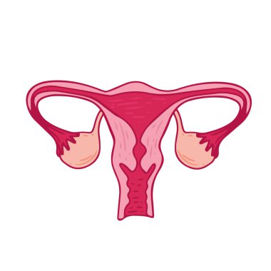 Kadın sağlığı - Polisistik yumurtalık sendromunun çiçek bilgileri. PCOS 'un hasta dostu şeması, çoklu foliküler kist. Jinekolojik sorunlar - Nötr tıbbi diyagram rahim ve rahim uzantıları