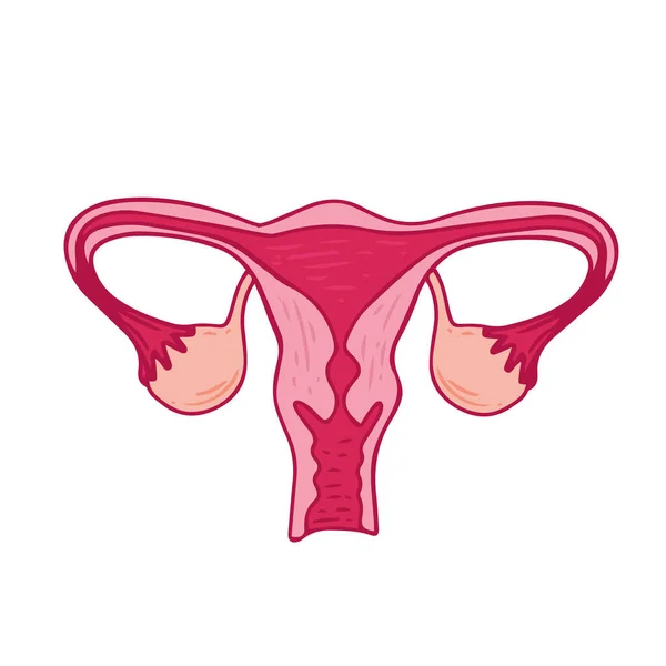 Frauengesundheit Florale Infografik Des Polyzystischen Ovar Syndroms Patientenfreundliches Pcos Schema — Stockvektor