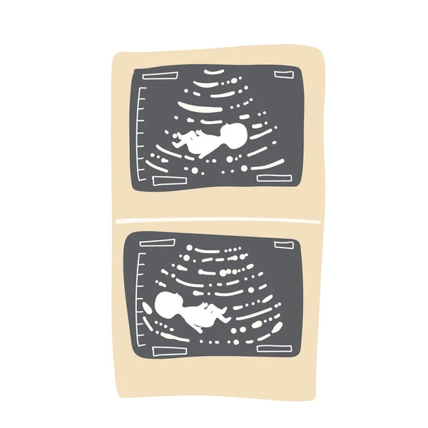 妊娠超音波黒と白の画像 子宮の中の赤ん坊 小さな赤ちゃんのシルエット医療写真 妊婦診療所検査 人間のベクターイラストを採用 ソノグラフィーテスト ベリースキャン — ストックベクタ