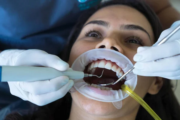 A woman\'s teeth are being treated at the clinic. An orthodontist uses dental instruments to place braces on a patient\'s teeth. Selective focus