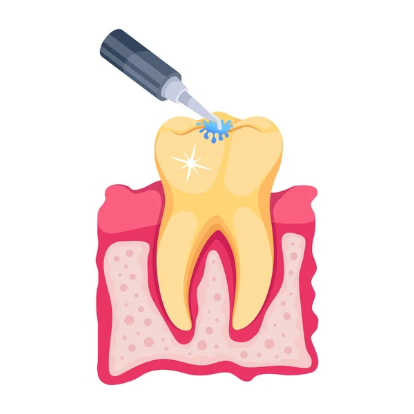 Trendy Icoon Van Tandheelkundige Behandeling — Stockvector
