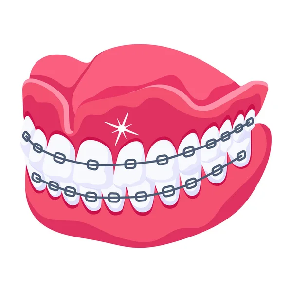 Diş Telli Dişler Vektör Illüstrasyonu — Stok Vektör