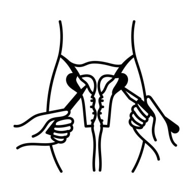 Histeroskopi ameliyatını betimleyen Doodle simgesi 