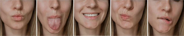 Collage Girl Mouth Emoji — Stock Photo, Image