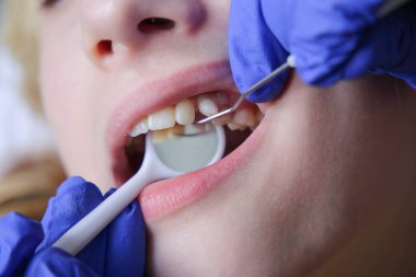 Çocuk diş hekimliğinde diş kontrolü yaptırıyor, yakın plan..