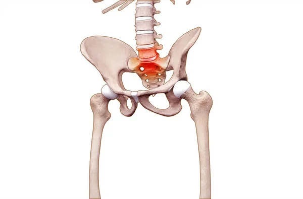 Медицинская Иллюстрация Поясничной Крестцовой Болью Скелете — стоковое фото