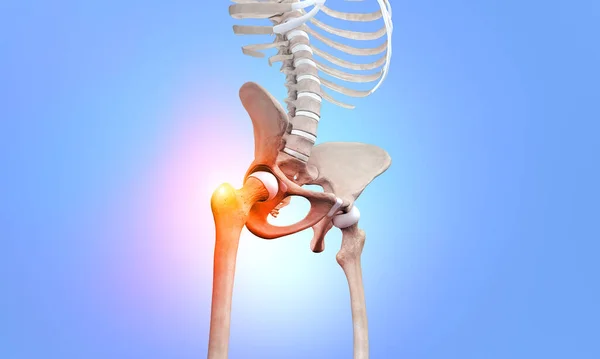 Femurhüftknochen Mit Schmerzen Menschlichen Skelett — Stockfoto