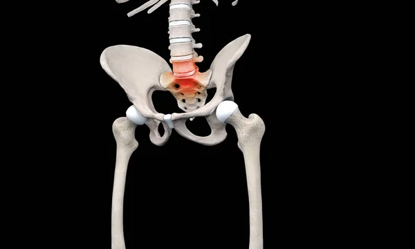 Dor Lombar Região Pélvica Esqueleto — Fotografia de Stock