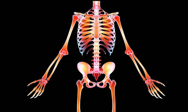 Radiografía Del Esqueleto Del Arco Iris — Foto de Stock