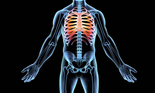 Röntgenbild Eines Menschlichen Skeletts Mit Rippenspitzen — Stockfoto