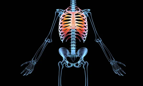 Ray Ett Mänskligt Skelett Med Revben Höjdpunkter — Stockfoto