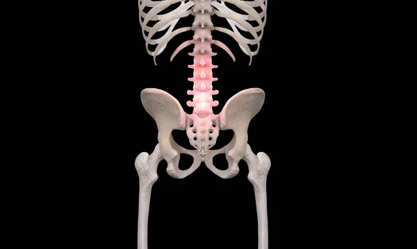 Σκελετός Πυελικός Πόνος Στην Πλάτη Μαύρο Φόντο — Φωτογραφία Αρχείου