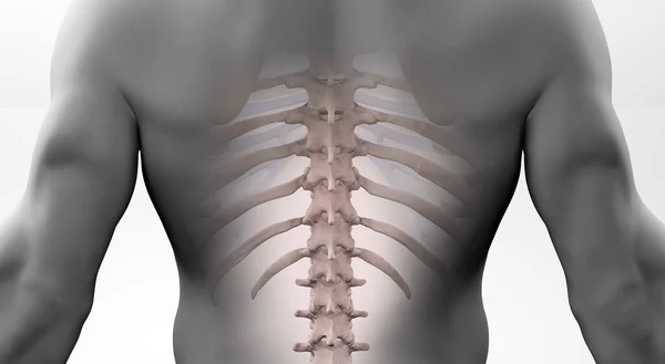 Röntgen Der Menschlichen Wirbelsäule Muskulösen Männlichen Körper — Stockfoto