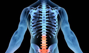 Lower Back Pain Photo