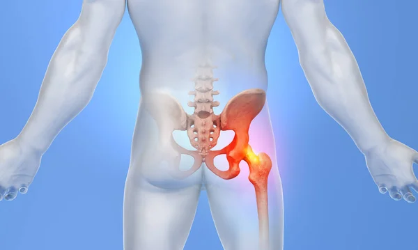 Hip pain with femur in red on male muscular body