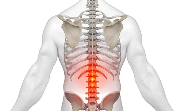 腰椎下部有红光 表示疼痛 — 图库照片