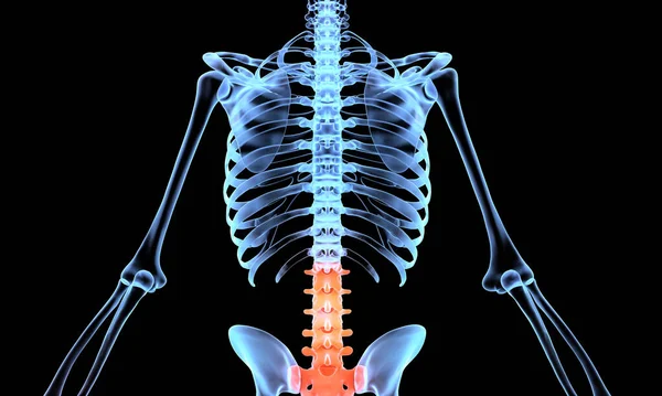 人脊椎X光 疼痛较轻 — 图库照片