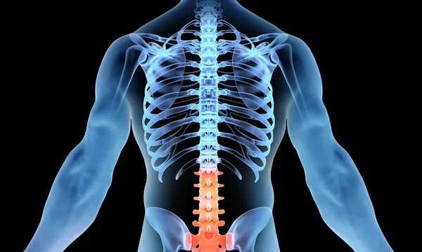 Lower lumbar spine region  x-ray indicating pain on blue male skeleton