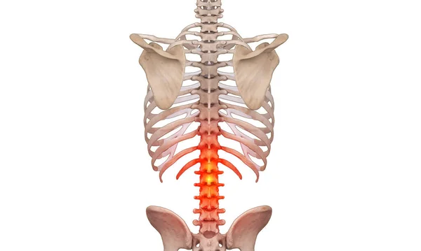 Lower Spine White Pain Highlights White Background — Stock Photo, Image
