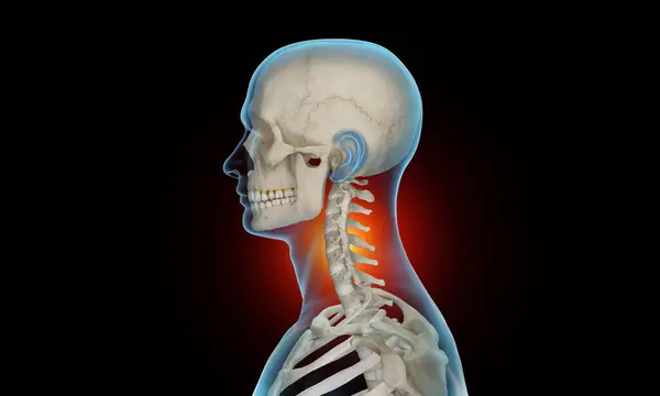 Seitenansicht Des Halswirbelsäulenschnitts Bei Wirbelsäulenverletzungen Und Schmerzen — Stockfoto