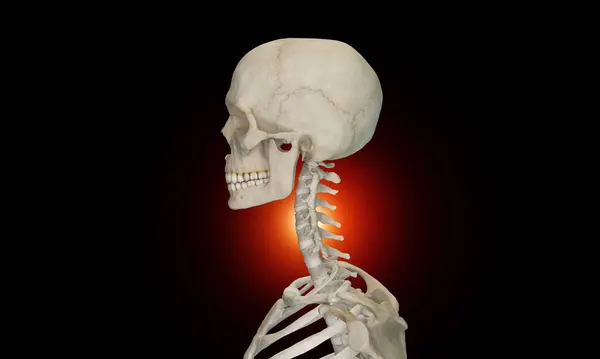 脊椎損傷および痛みの子宮頸部の側面の眺め — ストック写真