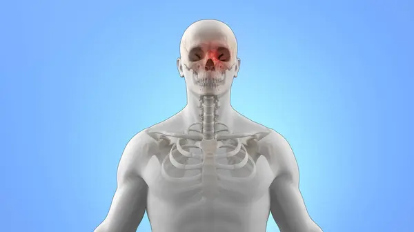 Ανθρώπινος Σκελετός Τροχιακό Κάταγμα Προσώπου — Φωτογραφία Αρχείου