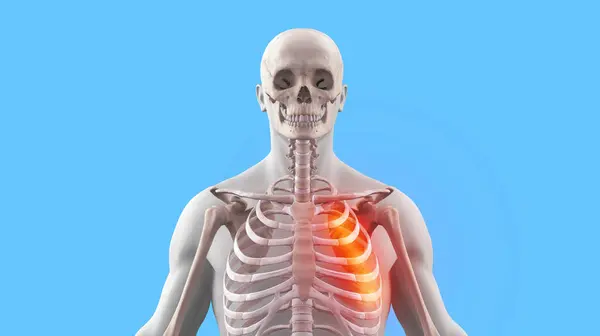 Ιατρική Απεικόνιση Του Ανθρώπινου Σκελετού Σπασμένα Πλευρά Royalty Free Φωτογραφίες Αρχείου