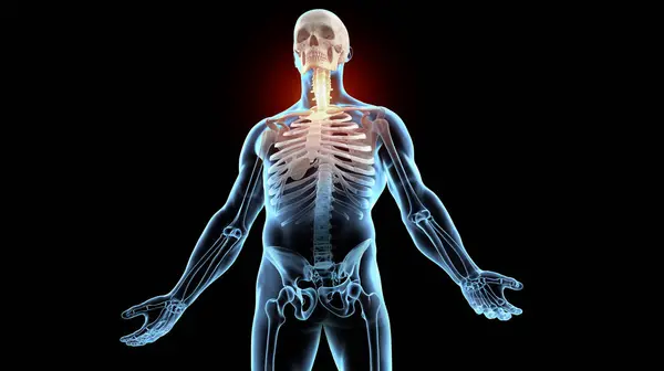 Ανθρώπινος Σκελετός Πόνο Στην Αυχενική Περιοχή Της Σπονδυλικής Στήλης — Φωτογραφία Αρχείου