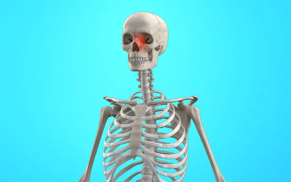 Ανθρώπινος Σκελετός Τροχιακό Κάταγμα Προσώπου Εικόνα Αρχείου