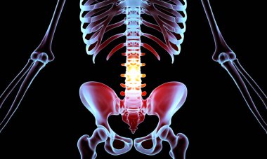 Lower Back Pain Photo