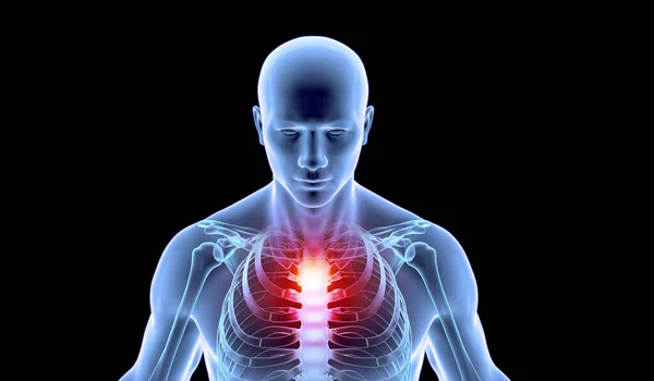 Ανθρώπινος Σκελετός Σημεία Πόνου Στο Στήθος — Φωτογραφία Αρχείου