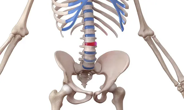 Διόγκωση Δίσκου Οσφυϊκής Μοίρας Σπονδυλικής Στήλης Ανθρώπινο Σκελετό Ιατρική Απεικόνιση Εικόνα Αρχείου