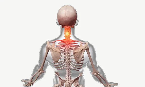 Ανθρώπινος Σκελετός Πόνο Στην Αυχενική Περιοχή Της Σπονδυλικής Στήλης — Φωτογραφία Αρχείου