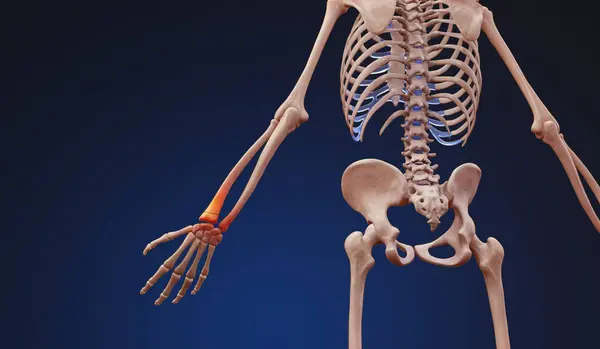 3D medical illustration of a human skeleton with wrist pain injury