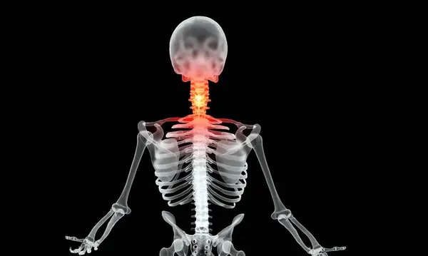 Ανθρώπινος Σκελετός Πόνο Στην Αυχενική Περιοχή Της Σπονδυλικής Στήλης Royalty Free Φωτογραφίες Αρχείου
