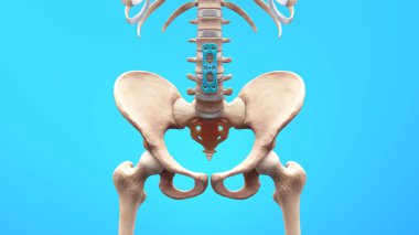 3B Ortopedik Omurga Sabitleme Omurga Sabitleyici Anterior Lumbar Plakası