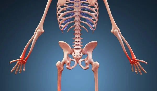 Ιατρική Απεικόνιση Ανθρώπινου Σκελετού Τραυματισμό Στον Καρπό Φωτογραφία Αρχείου