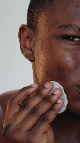 Vertikales Video Irritationen Gesicht Hautproblem Akne Behandlung Nahaufnahme Eines Genervten — Stockvideo