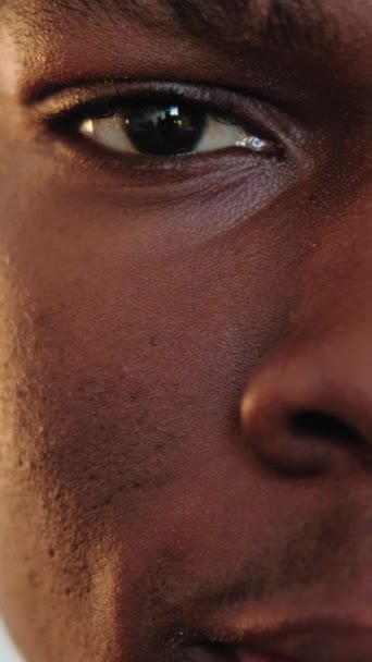 垂直ビデオ 皮膚の問題 顔のケア にきび治療 頬と鼻の上に詰まった大きな毛穴黒頭を持つ男の半分の顔の閉鎖 — ストック動画