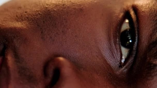 Vertikal Video Hudproblem Ansiktsvård Akne Behandling Närbild Mannens Halva Ansikte — Stockvideo