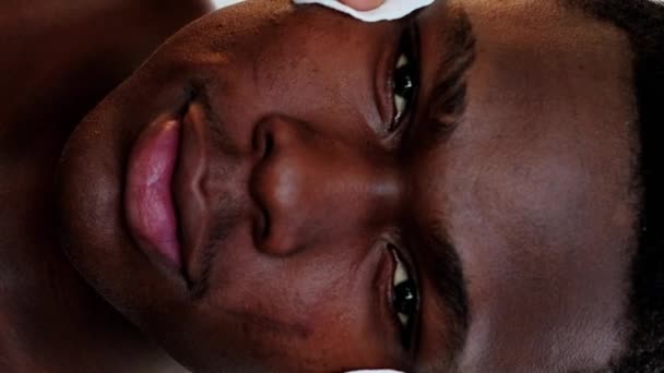 Вертикальне Відео Очищення Шкіри Лікування Акне Дерматологія Шкіри Обличчя Крупним — стокове відео
