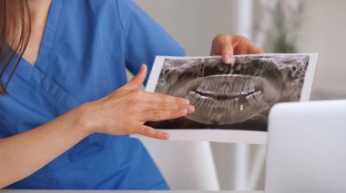 Ağız röntgeni. Diş radyolojisi. Diş bakımı. Tanımlanamayan kadın doktor ortodontist radyoloji uzmanı klinikte film taraması okuyor..